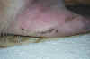 Bo's Suture after Stitch Removal 1 (02-2001).JPG (96954 bytes)